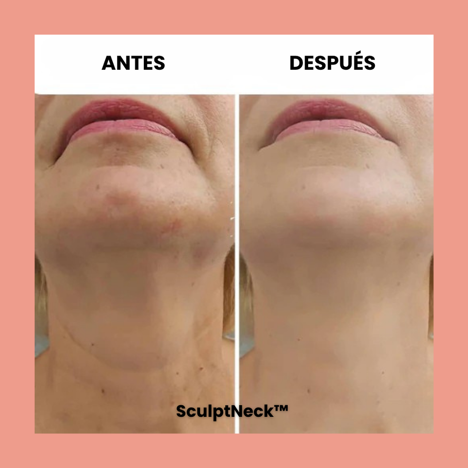 SculptNeck™ – Crema reafirmante para cuello y mentón