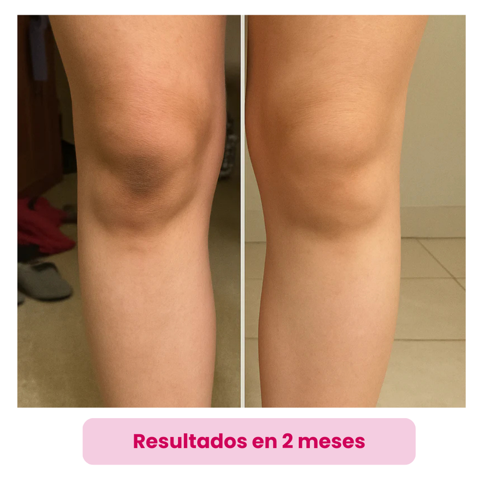 Serum SeoulGlow™ – Ilumina, Unifica y Rejuvenece
