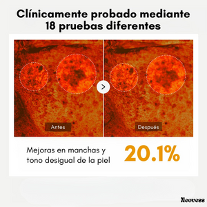 GlowPearls™ – Cápsulas de Vitamina C para iluminar y reafirmar la piel