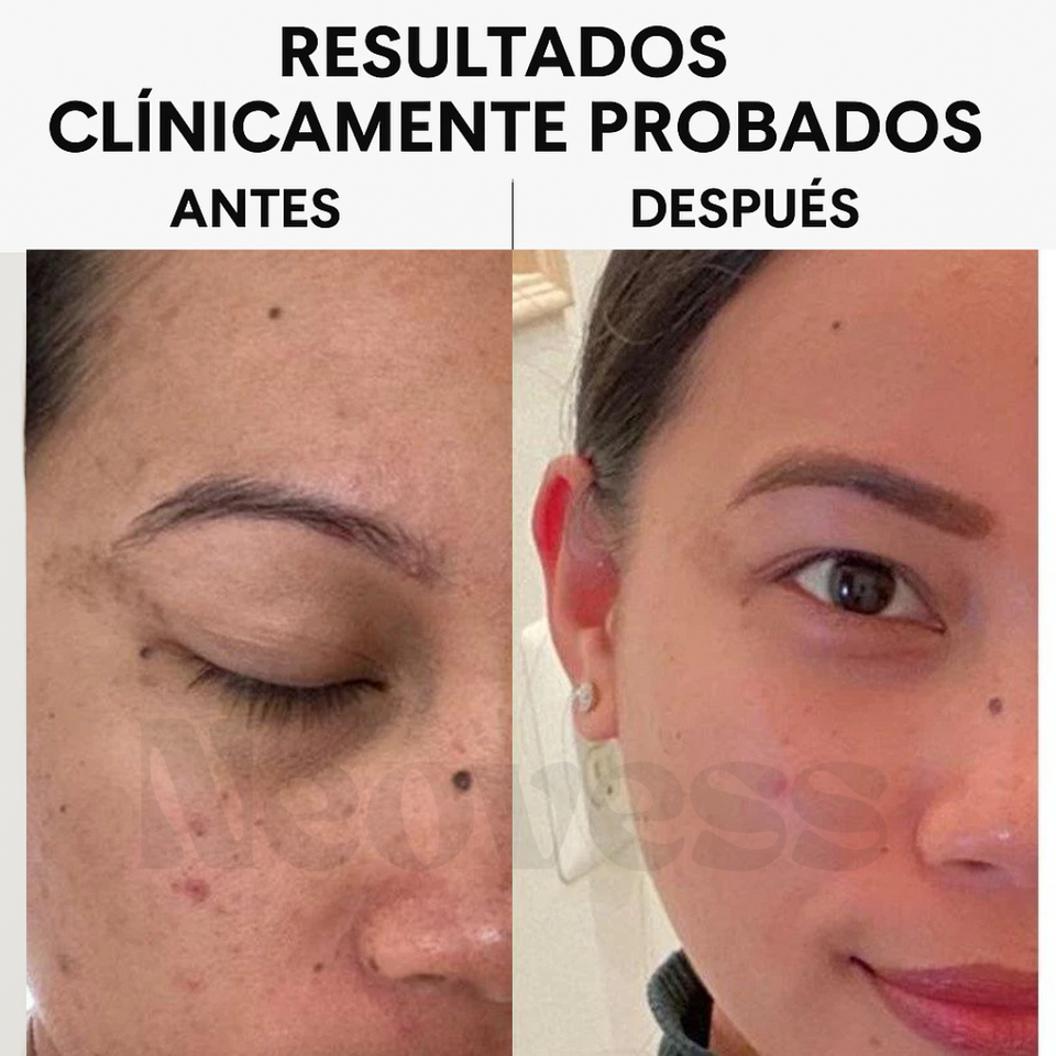 GlowPearls™ – Cápsulas de Vitamina C para iluminar y reafirmar la piel