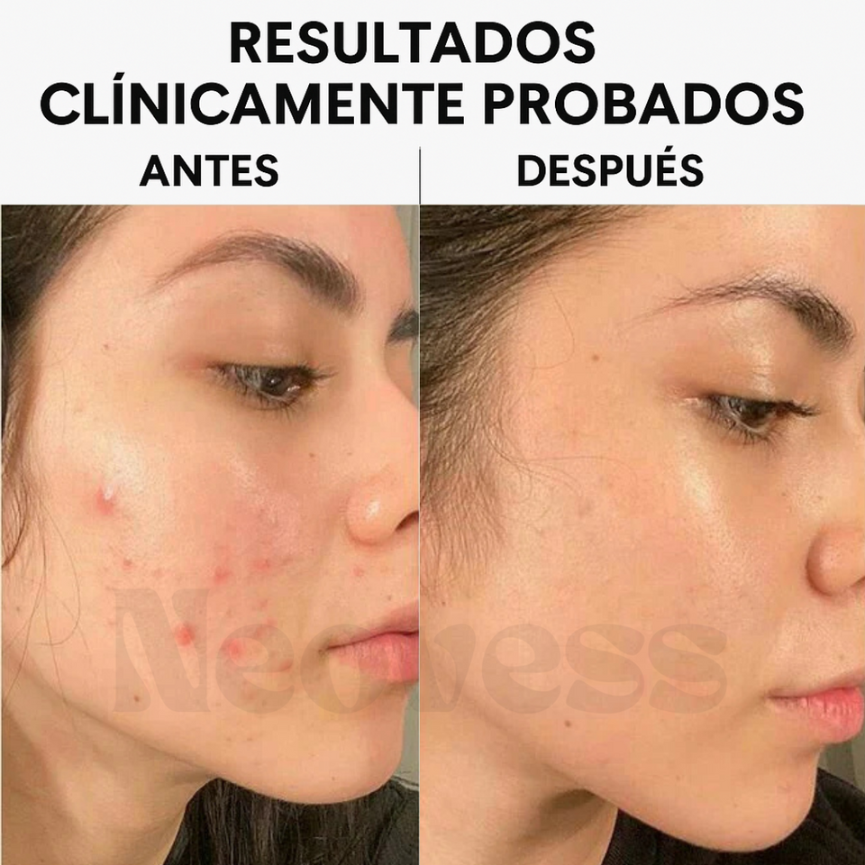 GlowPearls™ – Cápsulas de Vitamina C para iluminar y reafirmar la piel