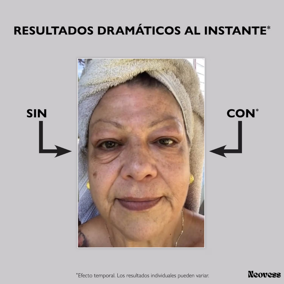 Instant FIRMx Eye™ - Lifting de ojos al instante