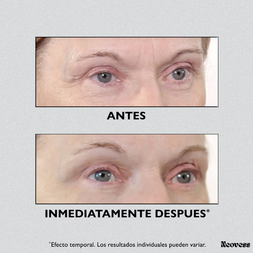 Instant FIRMx Eye™ - Lifting de ojos al instante