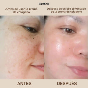 Crema de Colágeno con Niacinamida