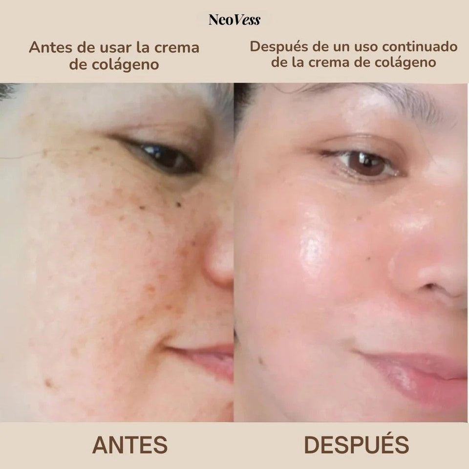 Crema de Colágeno con Niacinamida