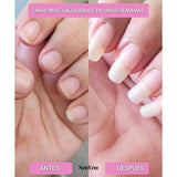 NeoVess Nail - Fortalece y Acelera el Crecimiento de tus Uñas