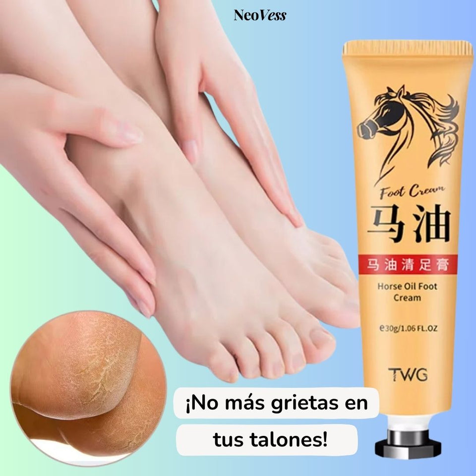 Crema de Aceite de Caballo™ - Adiós a los talones agrietados