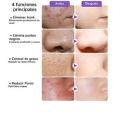 Mascarillas Faciales de Limpieza Profunda - Elige la Ideal para tu Piel